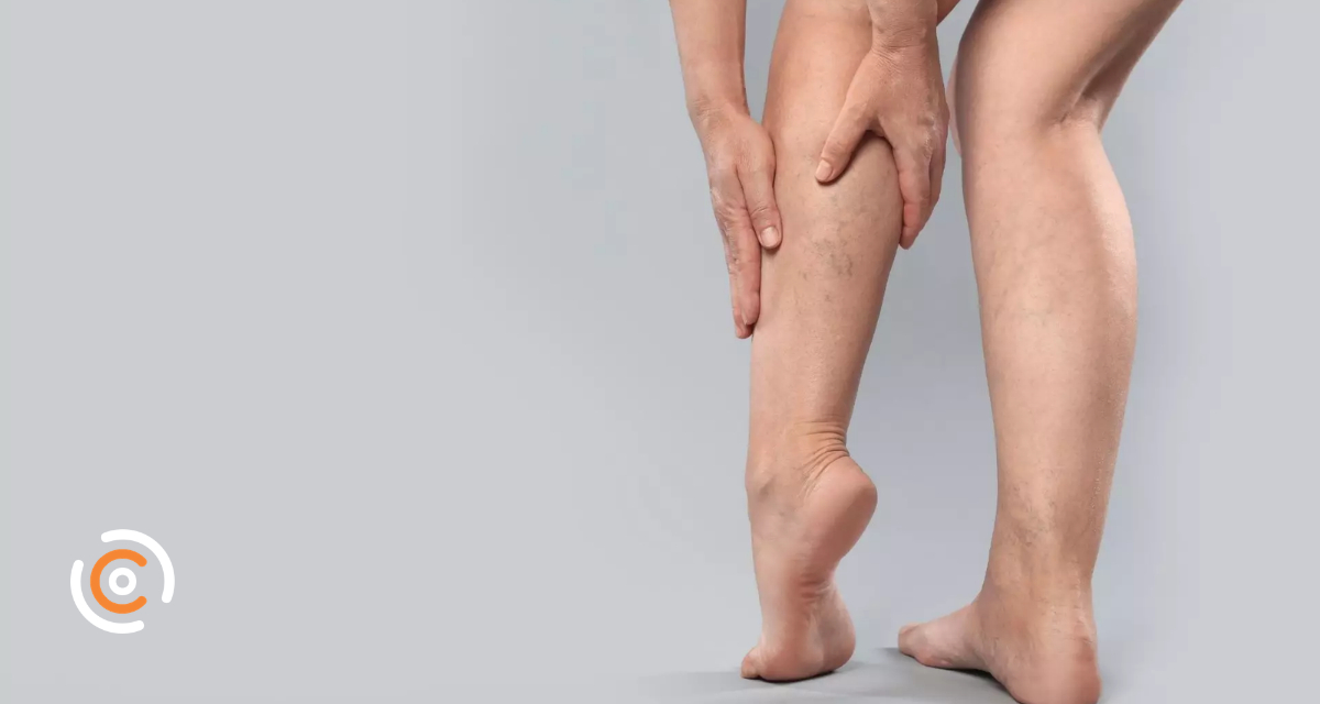 Dia Mundial da Trombose alerta para fatores de risco e cuidados preventivos